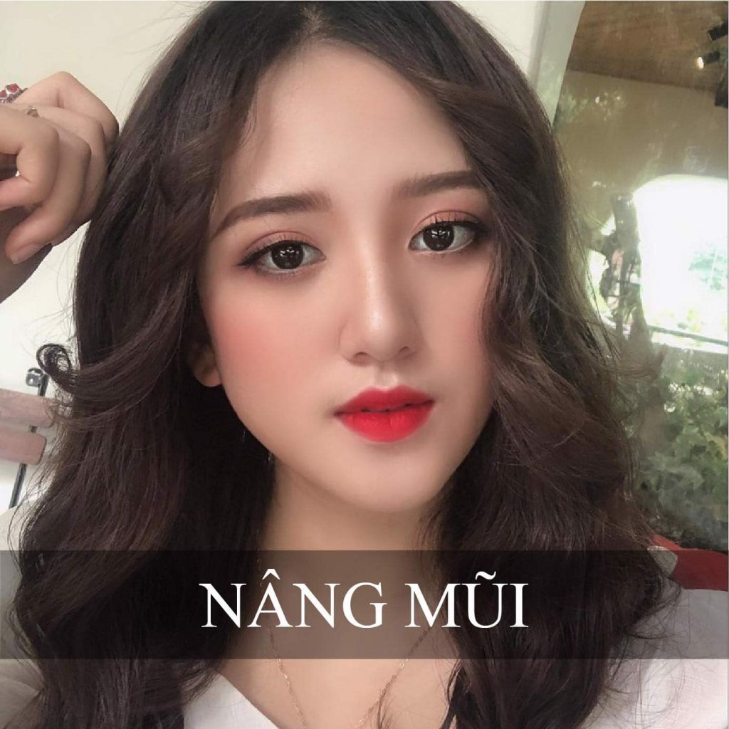 nâng mũi Hải Phòng